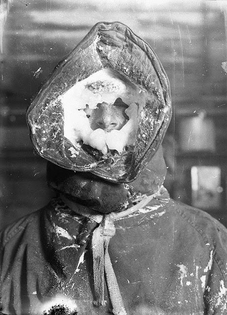 Ice mask, C.T. Madigan, 1912