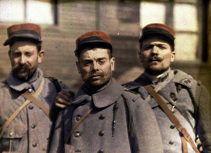 Three soldiers with conjunctivitis poisoned on March 23, 1918; medical photography. France, 1918