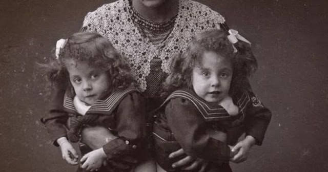 Bound By Flesh: 50+ Photos That Capture The Life Of Brave Conjoined Twins, Daisy And Violet Hilton