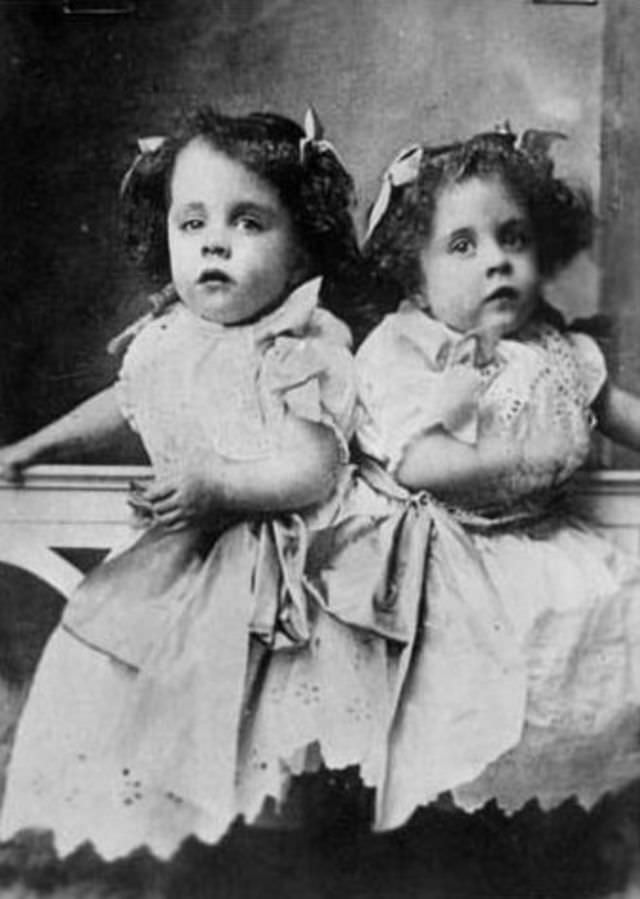 Bound By Flesh: 50+ Photos That Capture The Life Of Brave Conjoined Twins, Daisy And Violet Hilton