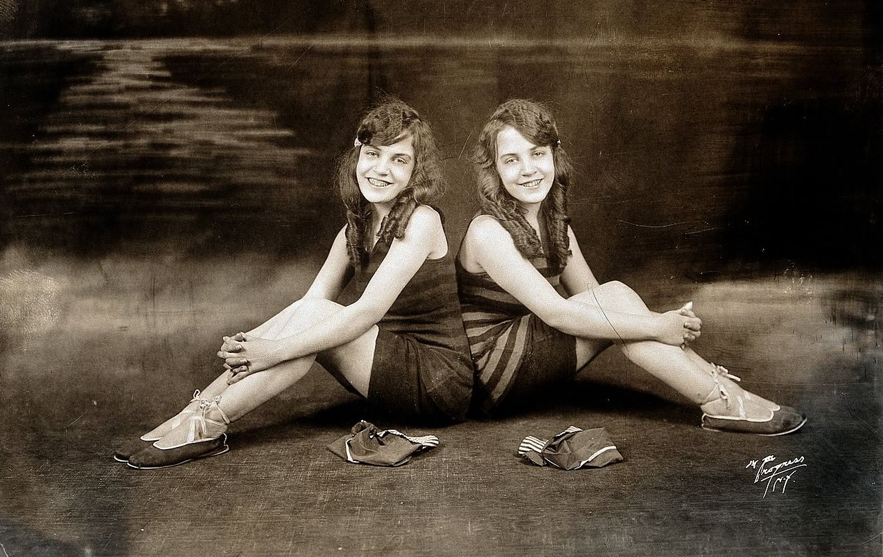 brave conjoined twins daisy violet hilton