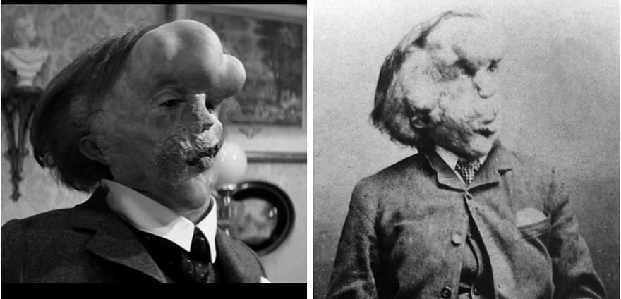 John Hurt as Joseph Merrick in The Elephant Man (1980)