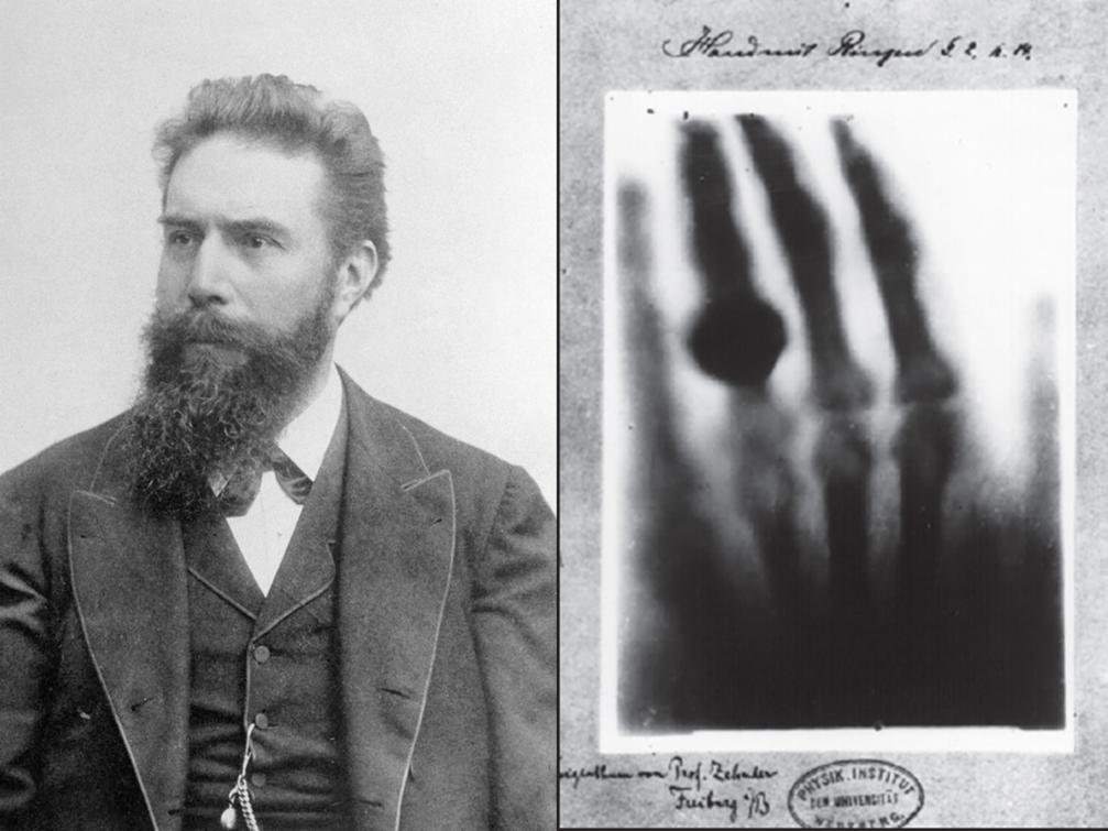 X-Rays (1895) by Wilhelm Conrad Rontgen