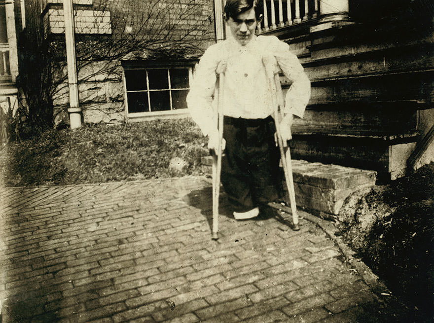 Frank p……., whose legs were cut off by a motor car in a coal mine in west Virginia when he was 14 years 10 months of age. Location: Monongah, west Virginia
