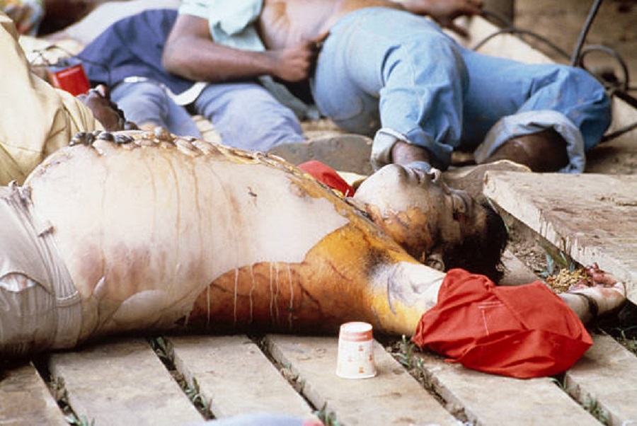 The Reverend Jim Jones’ bloated body lies on the ground after it was hastily sewn together after his autopsy by officials November 18, 1978 in Jonestown, Guyana.