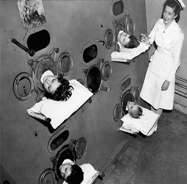 A gyermekbénulásban szenvedők többszemélyes vas tüdőbe helyezése, 1950 körül.