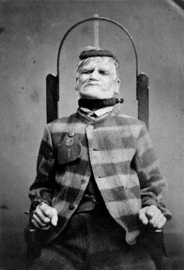 Egy beteg, aki visszatartó székben működik a West Riding Lunatic Menedékhelyen Wakefieldben, Yorkshire, Anglia 1869-ben.
