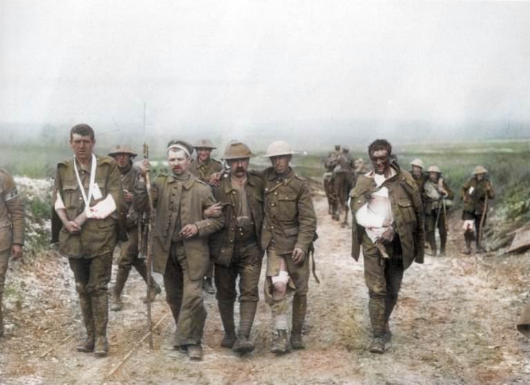 A German prisoner helps British wounded make their way to a dressing station near Bernafay Wood, following fighting on Bazentin Ridge, July 19, 1916, during the Battle of the Somme.