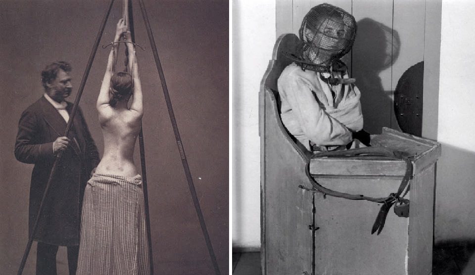 terrifying medical instruments and treatments
