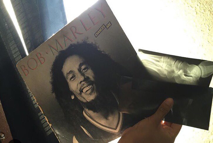 Found an x-ray of someone's foot inside this Bob Marley record!