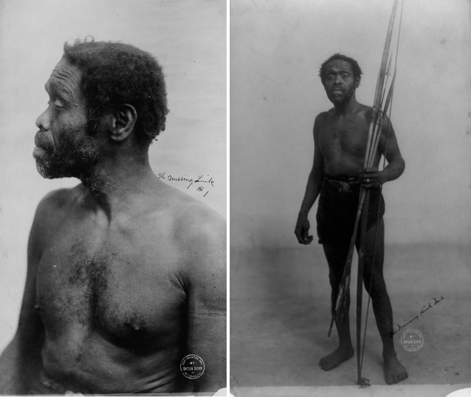 This unidentified African man was cruelly displayed as an exhibit at the 1904 St. Louis World’s Fair in Missouri. The words ‘the missing link’ were scrawled on both of the photos.