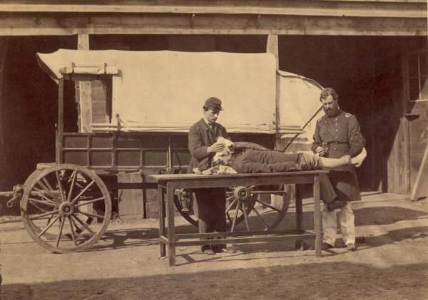 Army Medical Wagon. Demonstration of the use of anesthesia in amputations.