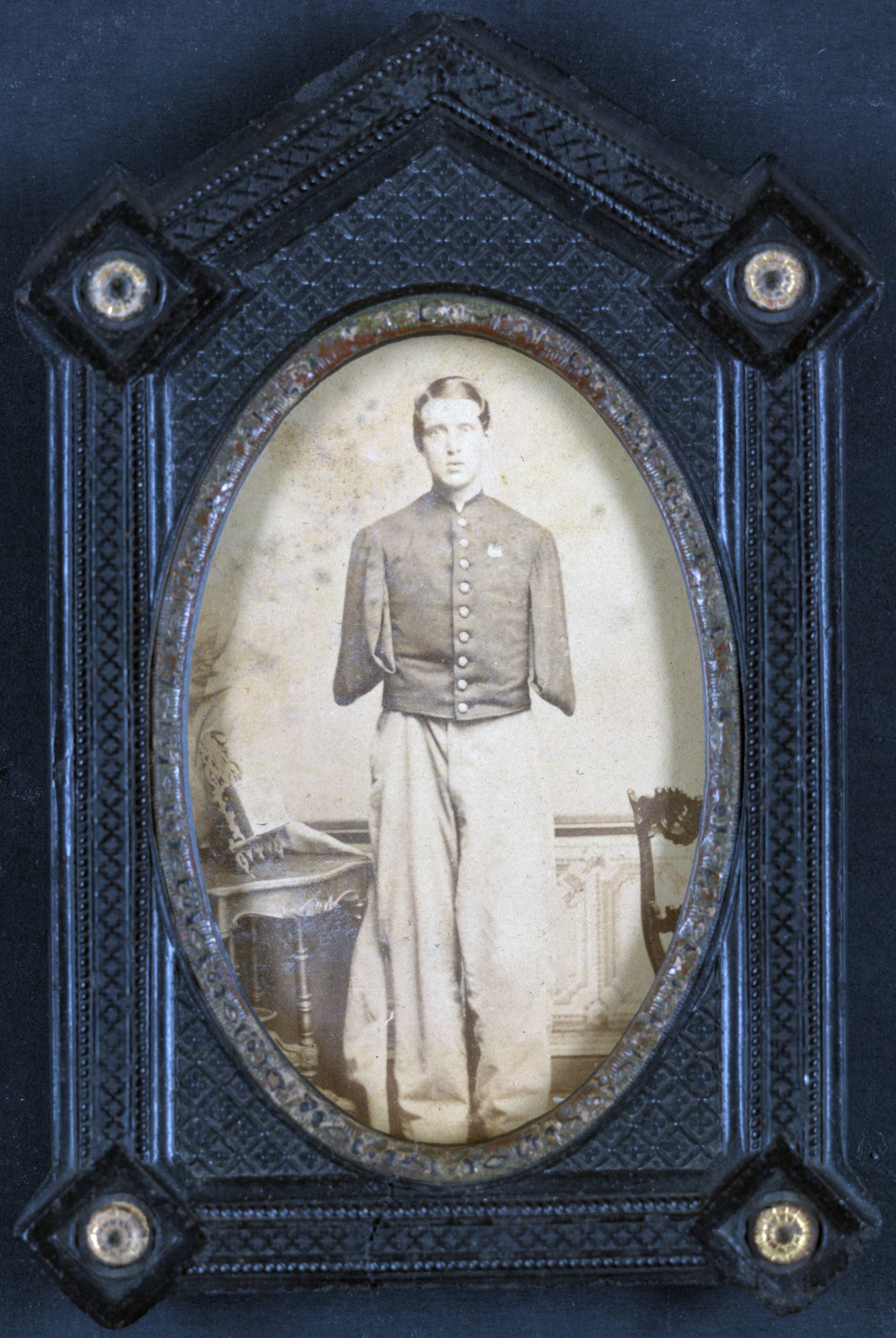 Sergeant Alfred A. Stratton of Co. G, 147th New York Infantry Regiment, with amputated arms. 1864.