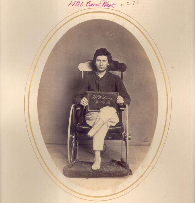 Hiram Williams had his leg and foot amputated due to a shell wound in the Battle of Appomattox in 1865.