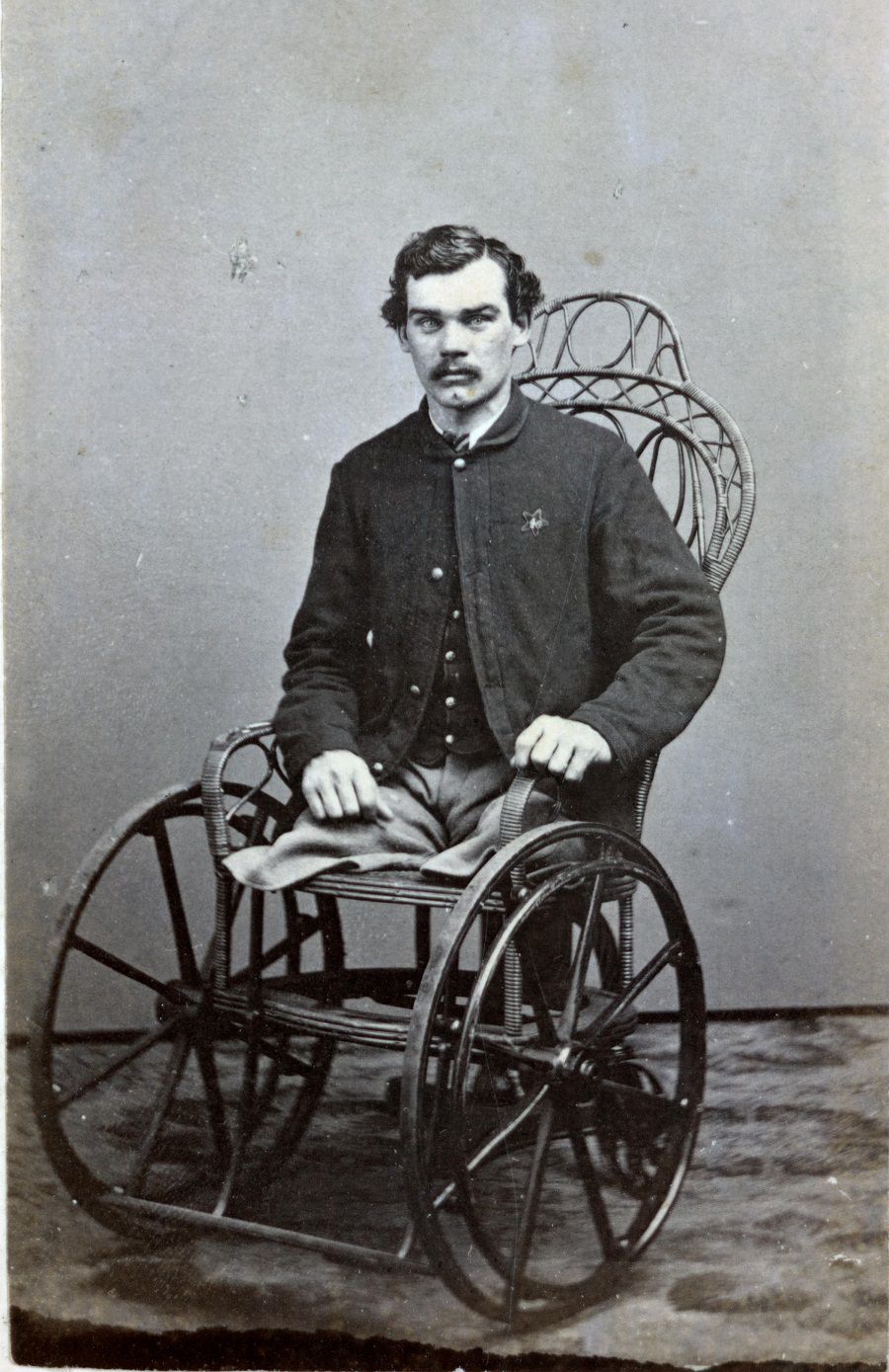 Corporal Michael Dunn of Co. H, 46th Pennsylvania Infantry Regiment, after the amputation of his legs in 1864.