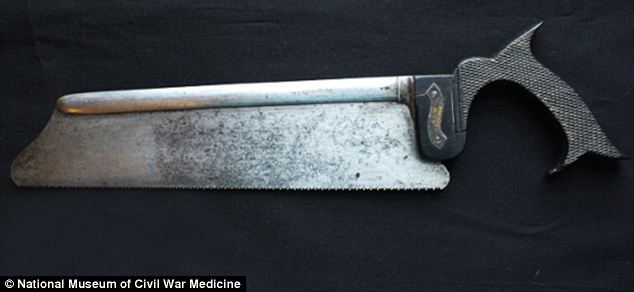 After skin and muscle had been were severed, this amputation saw - made with a steel blade and an ebony wooden handle - cut through bones