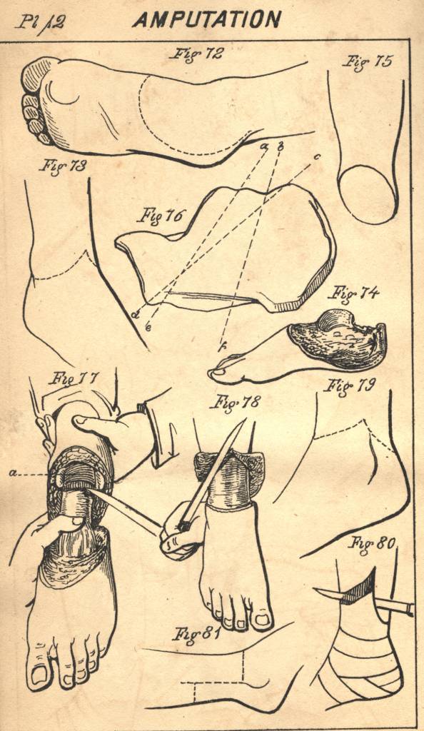 A Manual of Military Surgery, Confederate States of America, Surgeon General’s Office, 1863