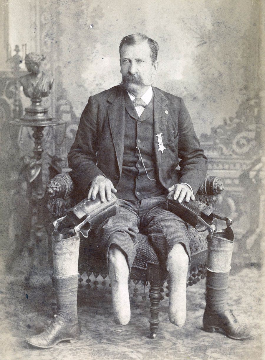 John W. January, veteran of Co. B, 14th Illinois Cavalry Regiment, with prosthetic legs in 1890.