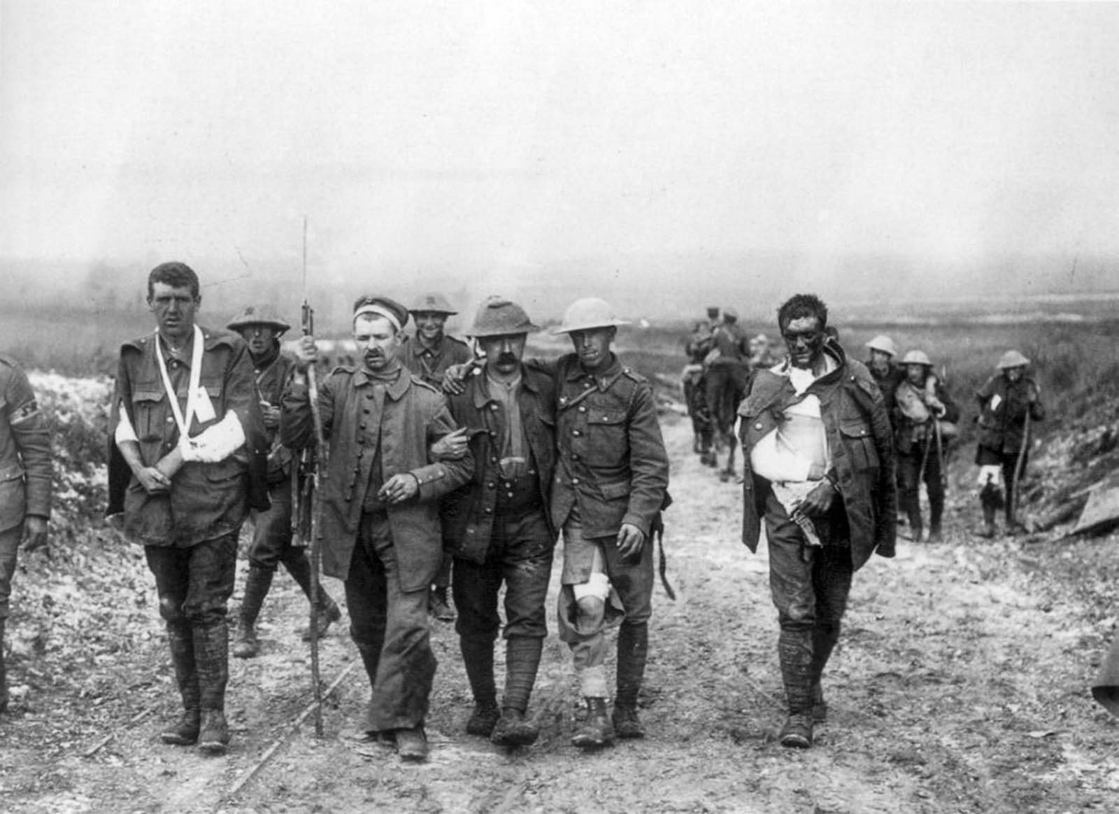 Wounded British soldiers return from the front lines.