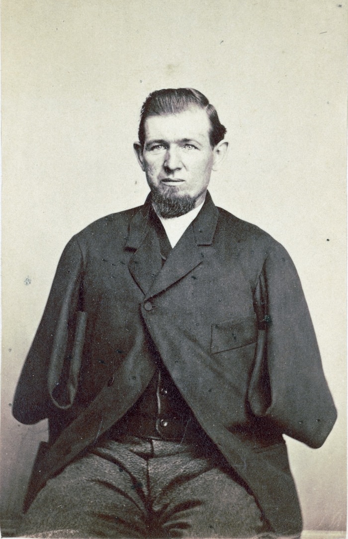 Private George W. Warner, wounded at Gettysburg on July 3, 1863, photographed in 1868