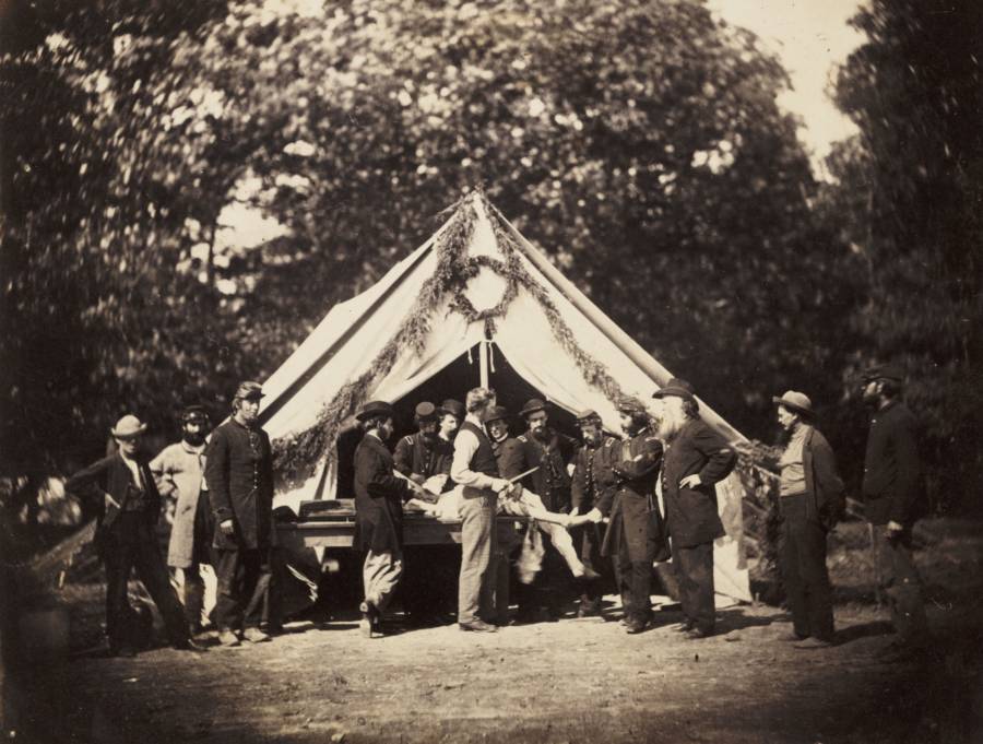 A surgeon performs an amputation on a wounded man as others stand by to assist.