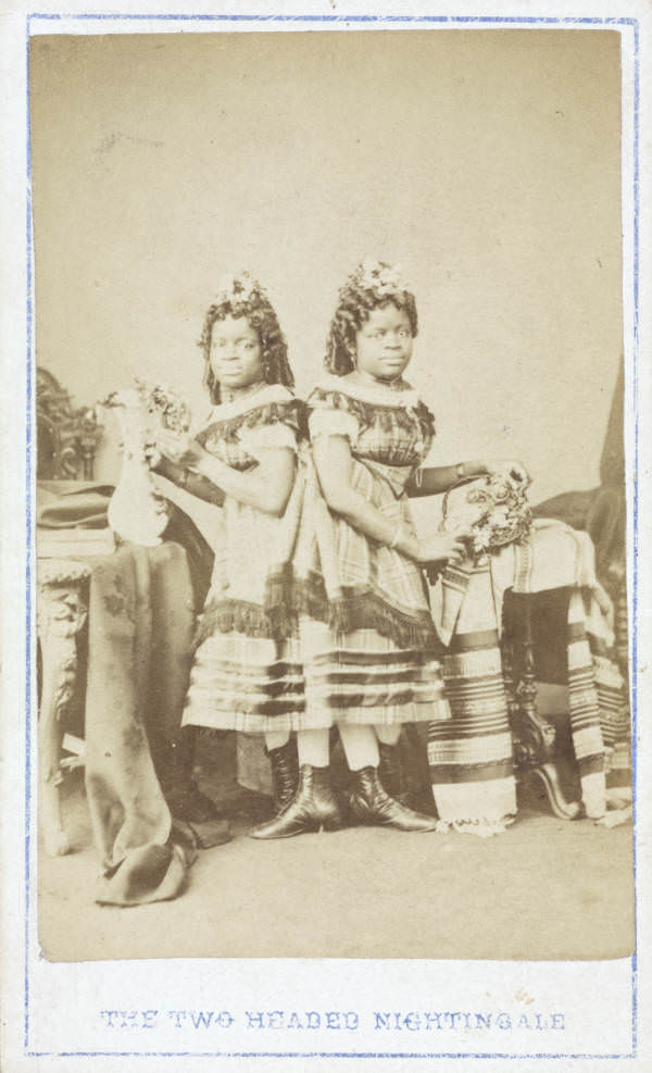 The Two-Headed Nightingale: Millie and Christine McKay were Siamese twins born into slavery in America's South. They were sold to be displayed as a "freak" show and toured the Northern USA and Europe as a singing duet.