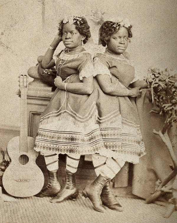 Born into slavery, conjoined twins Millie and Christine McCoy would later be sold to the circus and travel the world for 30 years as a singing novelty act, 1871