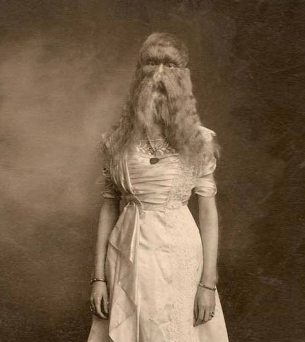 Born with the rare Hypertrichosis or "werewolf syndrome," Alice Doherty was put in a freak show by her mother at just two years old under the stage name "Wooly Girl.", 1902