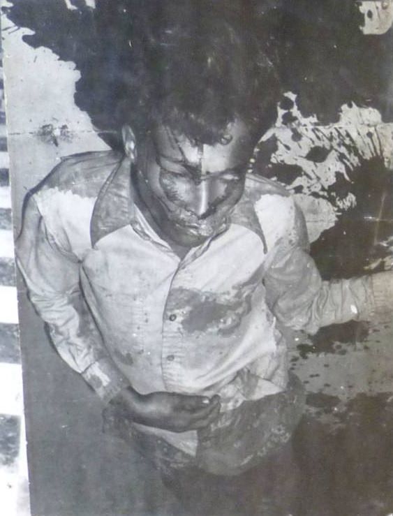 A prisoner bleeds on the floor of Tuol Sleng, Phnom Penh, 1976