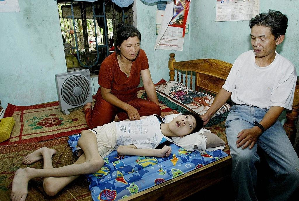 Le Anh The, a vietnami háború veteránja és felesége, Hoang Thi Huong, 45 éves, az Agent Orange ügynököt szemlélve a 17 éves fia, Le Anh Hung.