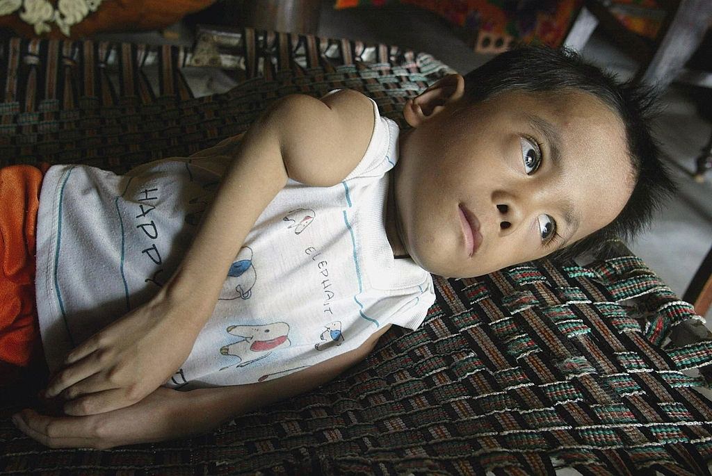 Eighth-year-old Agent Orange affected Hoang Trong Hung lies looking out from his house at Lien Thuy commune, 2004