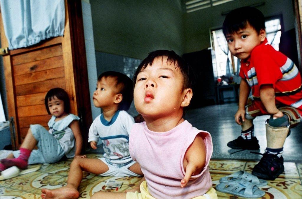 A group of children with malformations played in July 1993 at the Agent Orange Victim Care Center in the Tu-Du Hospital in Ho Chi Minh City.