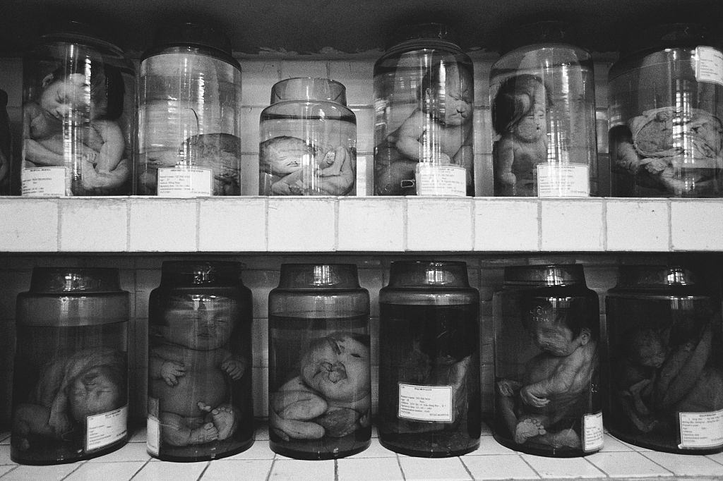 Jars of deformed fetuses following the mother's exposure to the herbicide Agent Orange on display at Tu Du Hospital in Ho Chi Minh City, 2005