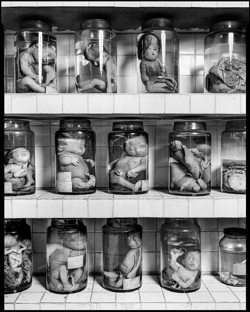 Jars at Tu Du Hospital which contain foetuses deformed as a result of the United States' herbicidal warfare program (Operation Ranch Hand) during the Vietnam War, Ho Chi Minh City, Vietnam, 1995.