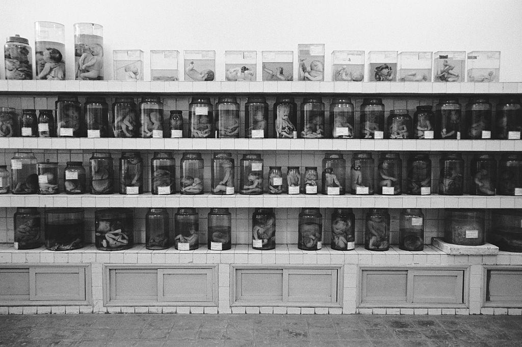 Jars of deformed fetuses following the mother's exposure to the herbicide Agent Orange on display at Tu Du Hospital in Ho Chi Minh City, 2005