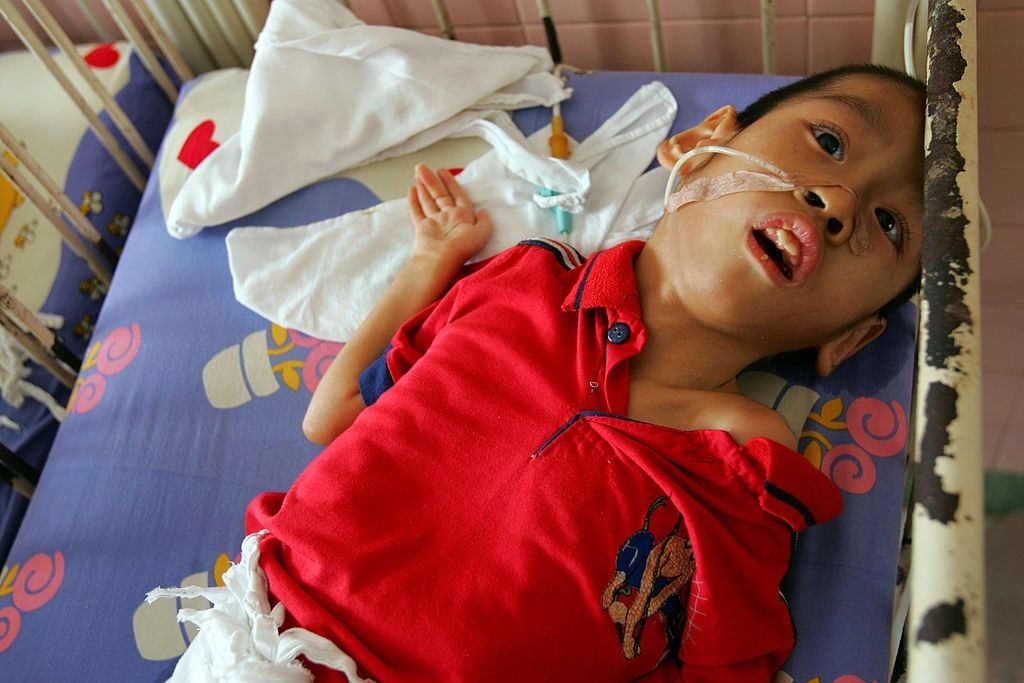 A handicapped child lies in his crib at the Tu Du hospital May 1, 2005 in Ho Chi Minh City