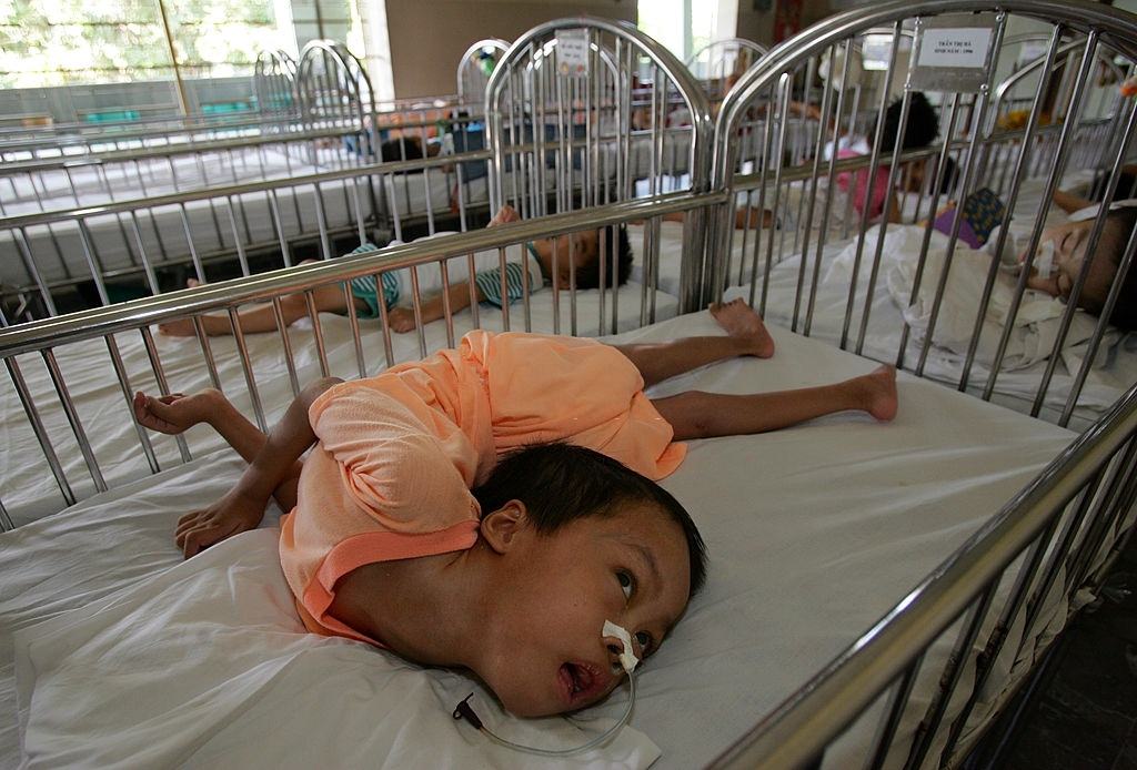 Khung Thoung Sinh, age 3, sucks his thumb at the Tu Du Hospital May 2, 2005