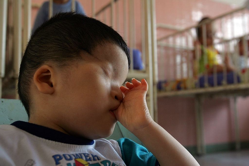 Tran Thi Ha, 9 years, lies in a crib at the Tu Du hospital May 1, 2005 in Ho Chi Minh City. He has been deformed since birth from the effects of the defoliant Agent Orange