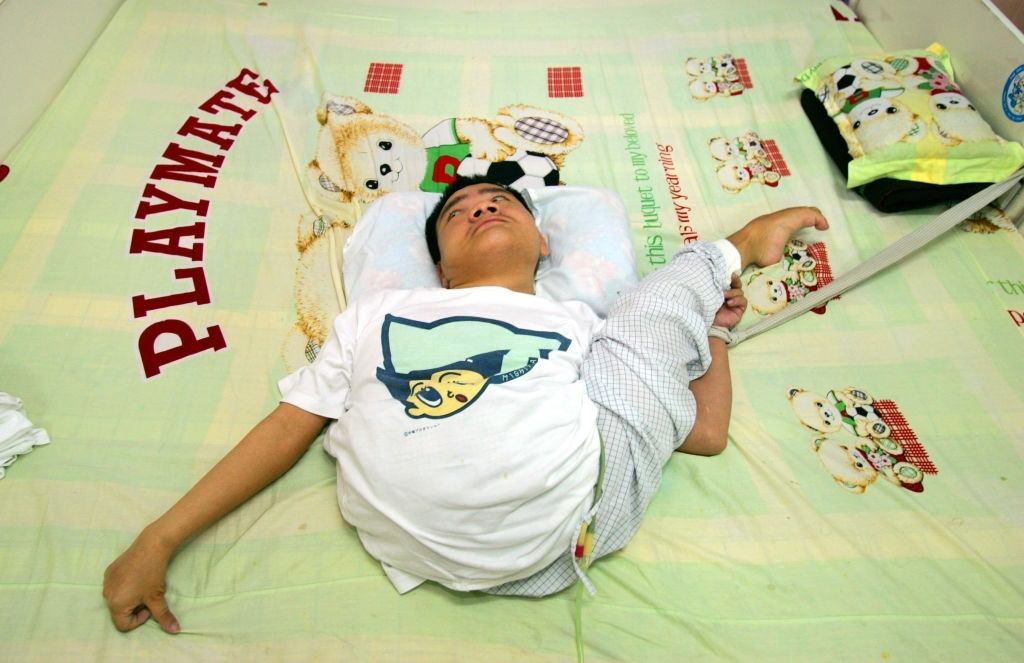 Nguyen Viet, 23 years old, lays on his bed at the Tu Du Hospital May 2, 2005