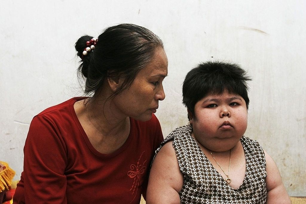 Agent Orange victim Nguyen Thi Nam Ha, 21 is taken care of by her mother Tran Thi Huyen, 57, at their house in Vung Tau.