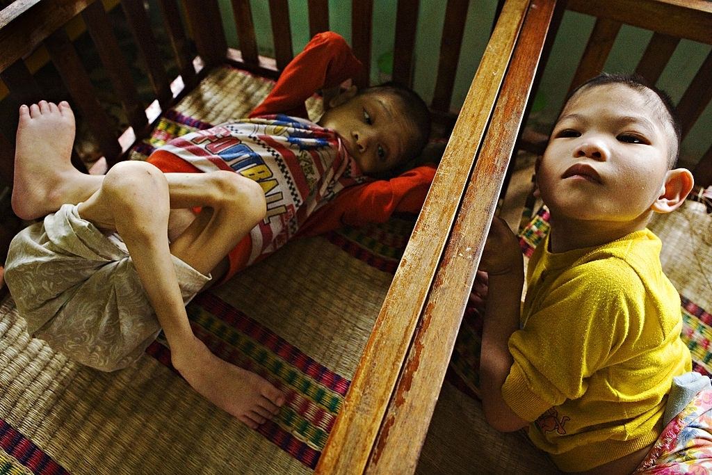 Children abandoned by their parents at birth at the Centre of Aged People and Disabled Children in Ba Vi district, Ha Tay province