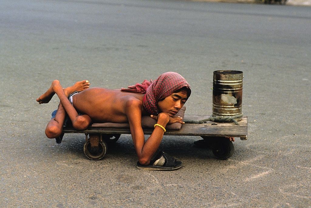 A disabled and malformed victim of foliant Agent Orange, begs on the streets of Saigon to make a living, 1996
