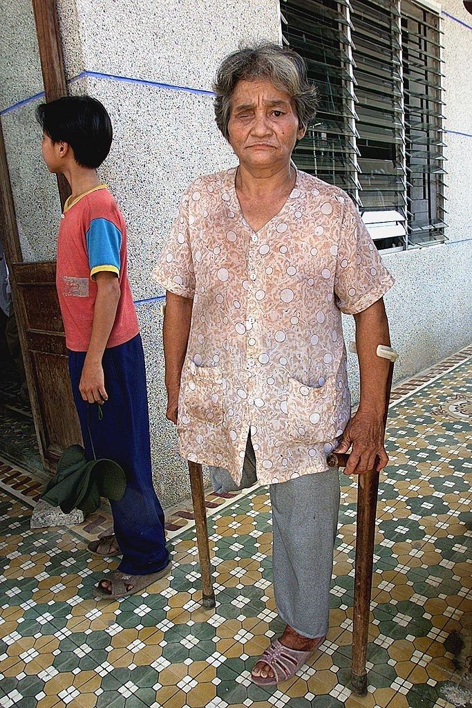 Tran Thi Chua, 59, a landmine victim from the Vietnam War, 2000