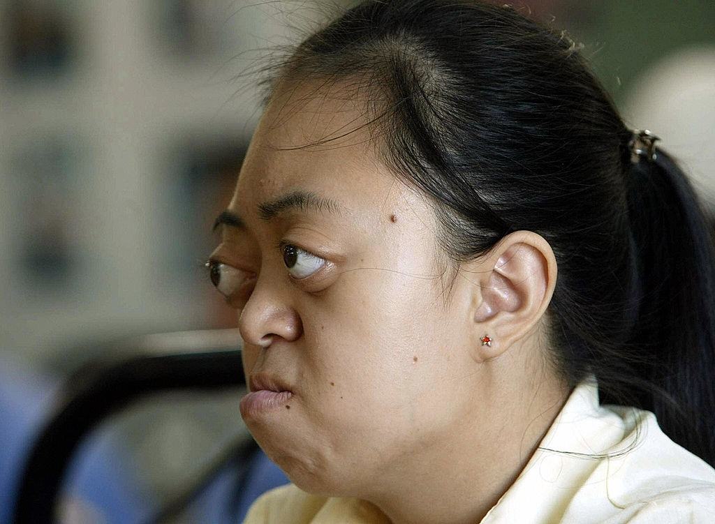 Nguyen Thi Van Long, 17, a victim of the agent orange, 1998