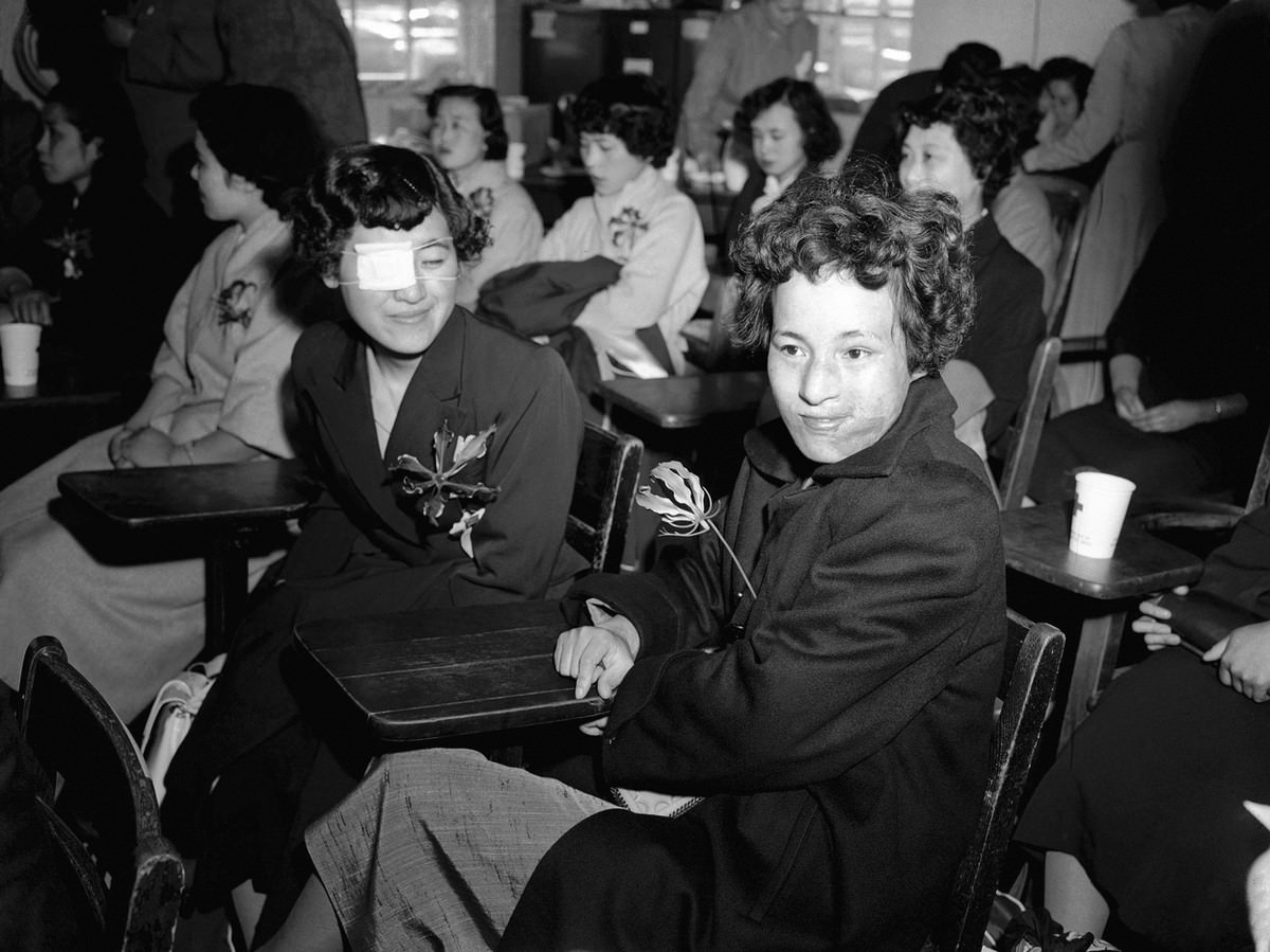 Japanese girls Mitsuko Kuranoto, left, and Emiko Takemoto, survivors of the Hiroshima atomic bombing 10 years earlier, face newsmen and photographers at the Mitchel Air Force base on Long Island, New York, on May 9, 1955.