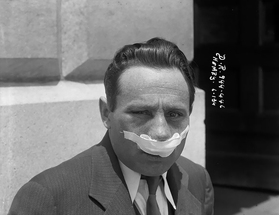 Chinatown: An assault victim poses for the camera – 1934.
