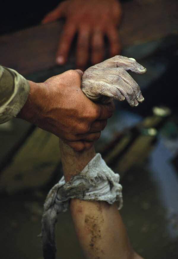 The deathly white hand of Omayra Sánchez.