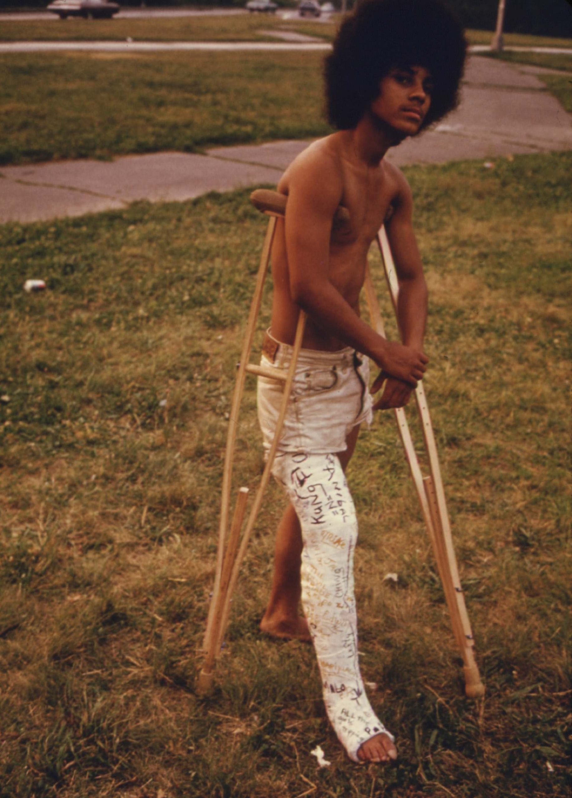 Young Man with His Leg in a Cast in Hiland Park of Brooklyn, July 1974.