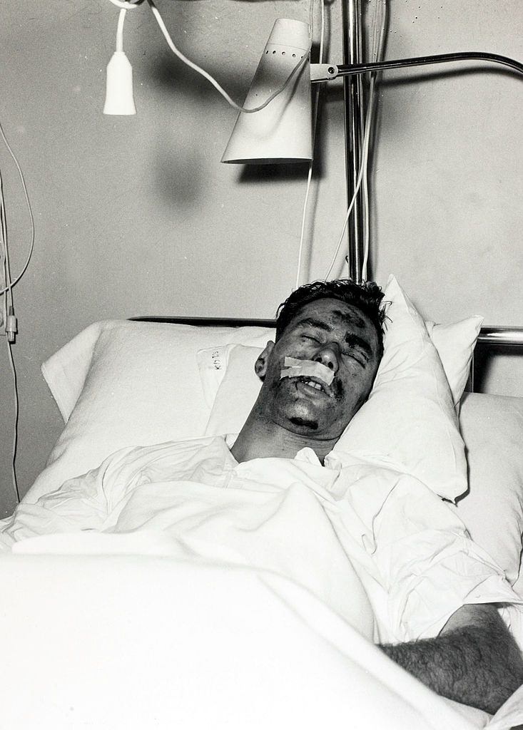 Manchester United's goalkeeper Ray Wood in the Isar hospital in Munich. February 1958.