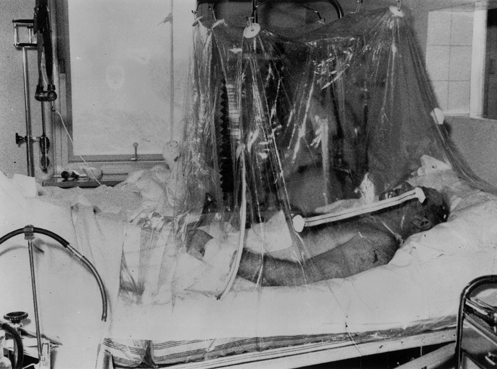 Manchester United football manager Sir Matt Busby lying in an oxygen tent in Munich Hospital. 8th February 1958
